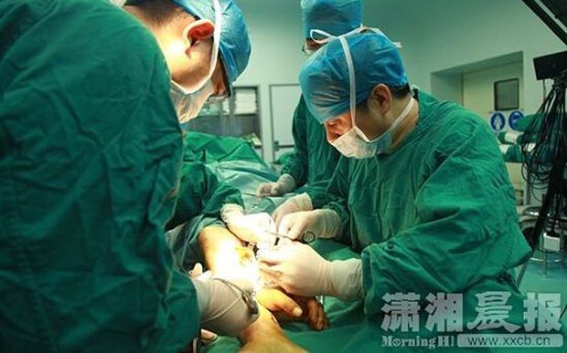 Китайські хірурги пришили руку пацієнта до його ноги: фотофакт