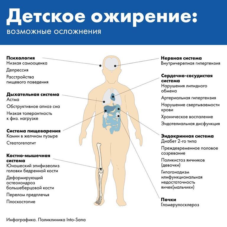 Детское ожирение в Украине: как родители раскармливают своих малышей