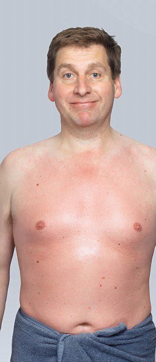 Откровение мужчины, который удалил волосы на теле ради жены: фото до и после