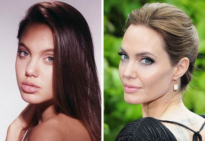 Самые красивые подправленные носы знаменитостей: фотоподборка