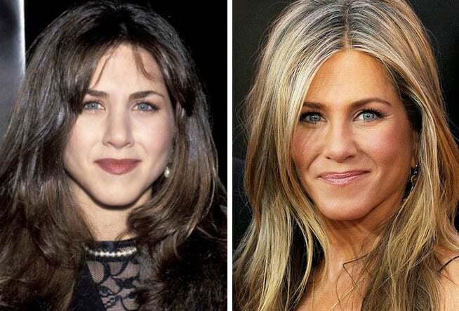 Самые красивые подправленные носы знаменитостей: фотоподборка