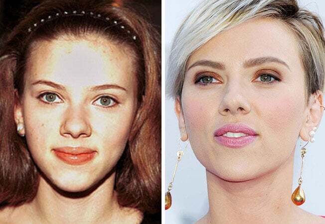 Самые красивые подправленные носы знаменитостей: фотоподборка
