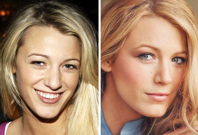 Самые красивые подправленные носы знаменитостей: фотоподборка