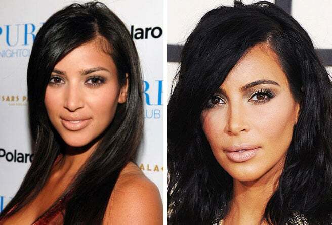 Самые красивые подправленные носы знаменитостей: фотоподборка