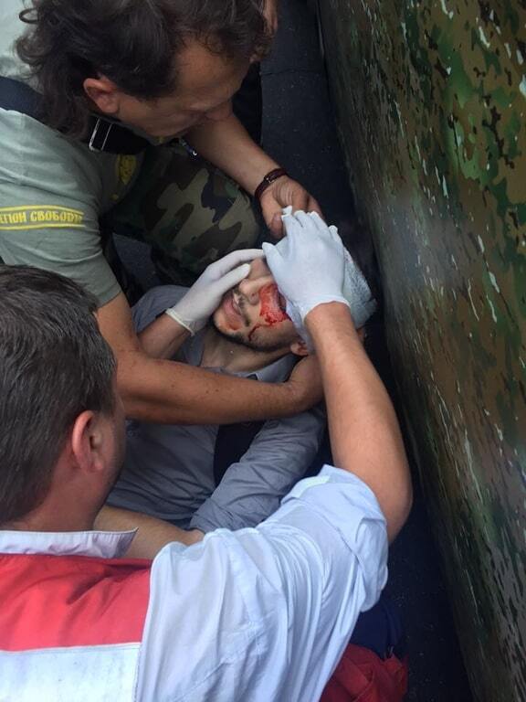 В столкновениях под Радой разбили голову французскому журналисту: фотофакт