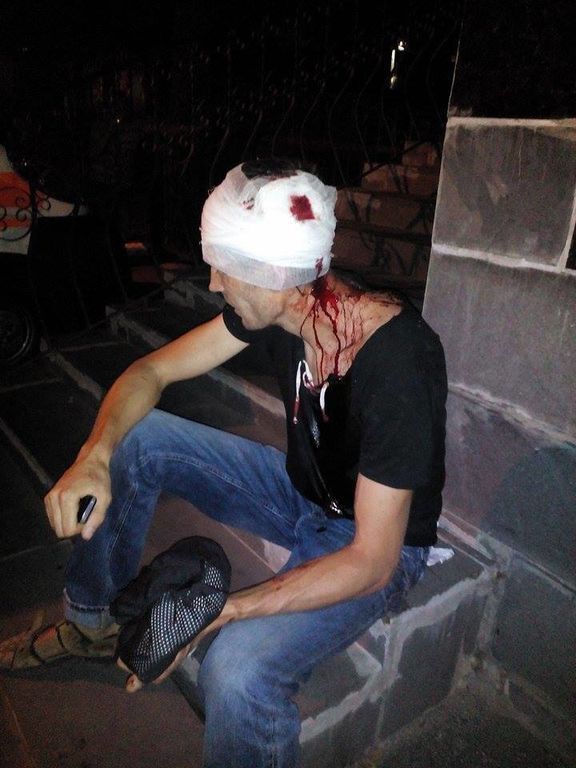 На Киевщине жестоко избили активиста 