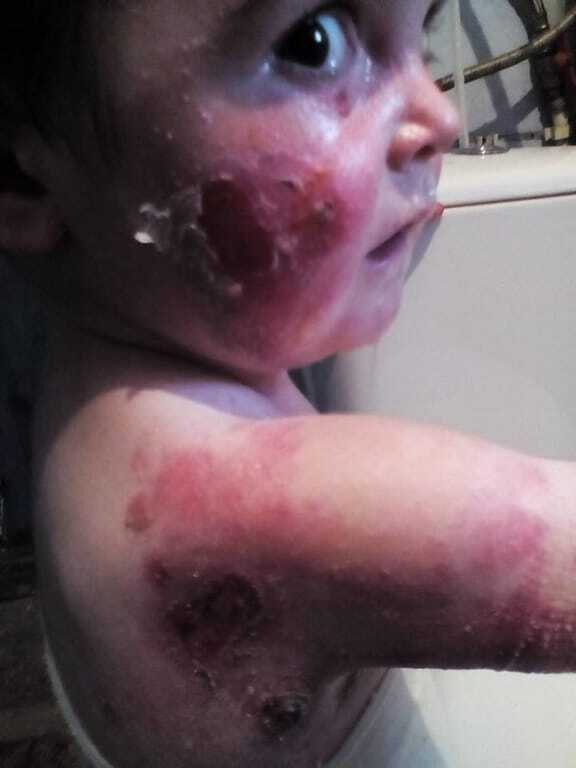 Волонтеры бьют тревогу: малышам нужна помощь