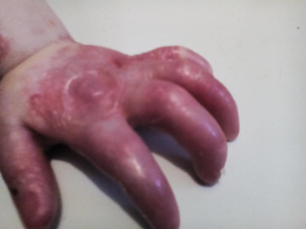 Волонтеры бьют тревогу: малышам нужна помощь