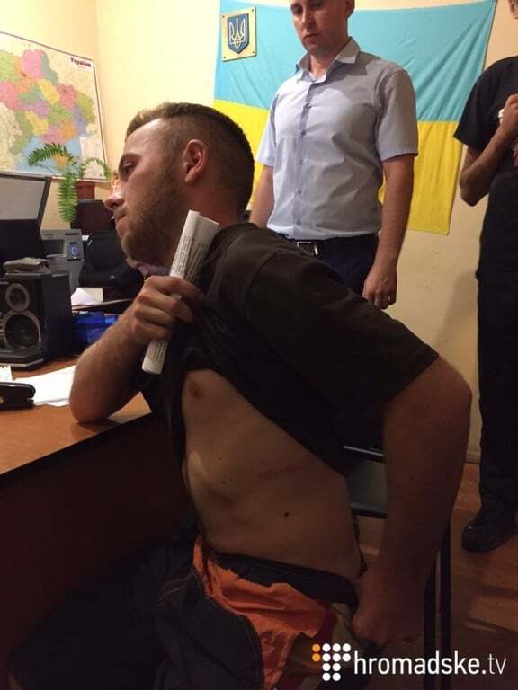 Затриманого під Радою бійця батальйону "Січ" били заради показань - адвокат