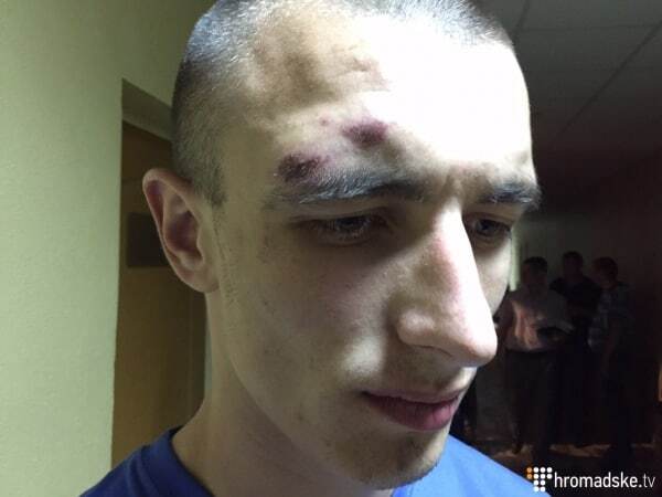 Затриманого під Радою бійця батальйону "Січ" били заради показань - адвокат