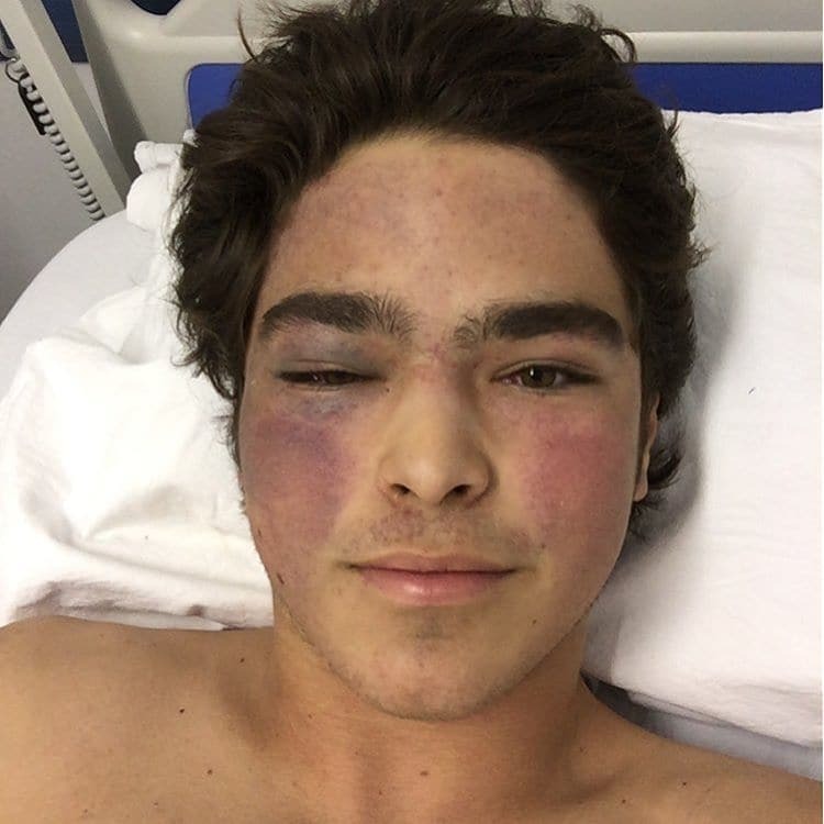 17-летний сын легенды Формулы-1 попал в жесточайшую аварию: видео крушения