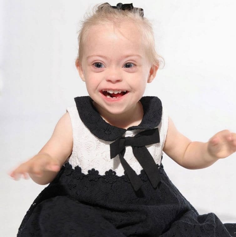 Двухлетняя малышка с синдромом Дауна стала моделью благодаря лучезарной улыбке