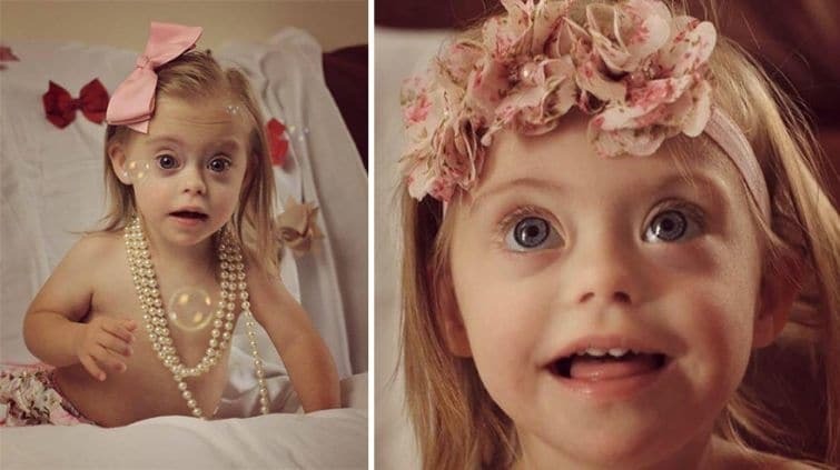 Двухлетняя малышка с синдромом Дауна стала моделью благодаря лучезарной улыбке