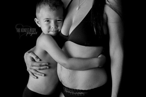 15 фотографий о красоте женского тела после родов