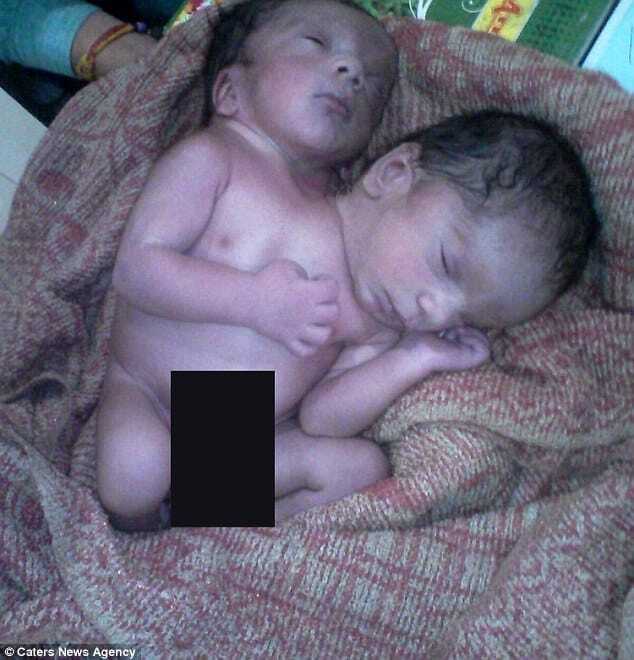 Чудо природы: в Индии родился двухголовый ребенок. Фотофакт