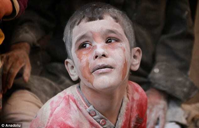 Окровавленные и шокированные: журналисты показали детские лица войны в Сирии. Фоторепортаж