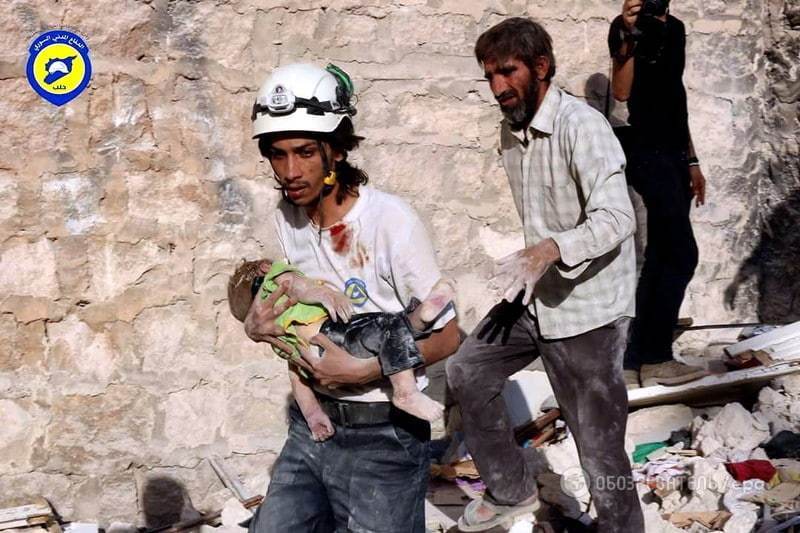 Покалеченные дети и разрушенный город: в Алеппо за два дня погибло 145 человек