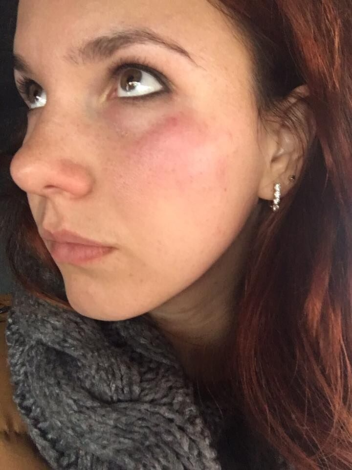 Люди Балашова избили девушку, защищая незаконную кофейню - СМИ