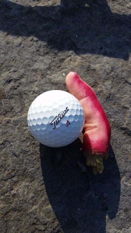 Ирландскому футболисту оторвало палец во время неудачного прыжка: фотографии не для слабонервных