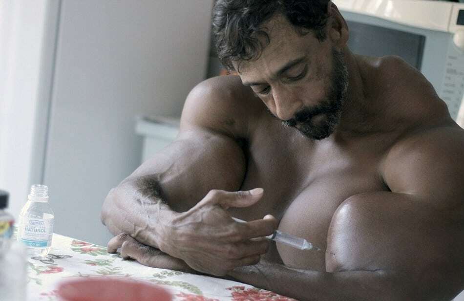 Бразильский культурист шокировал соцсети своим видом после инъекций масла: фото не для слабонервных