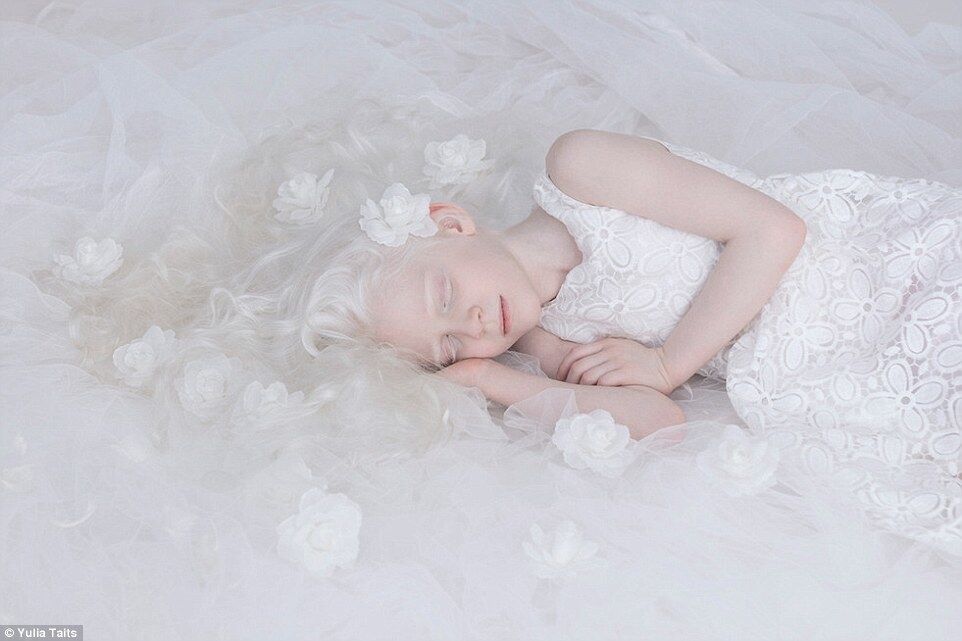 Пятьдесят оттенков белого: фотограф показала гипнотизирующую красоту альбиносов. Фоторепортаж