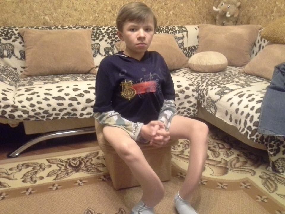 Понад 30 переломів за 13 років: хлопчик зі Львова потребує термінової допомоги