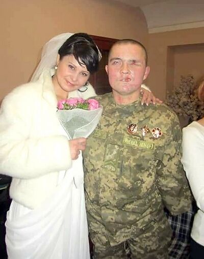 "Не давали й 3% на життя": історія весілля тяжкопораненого бійця АТО розчулила Україну