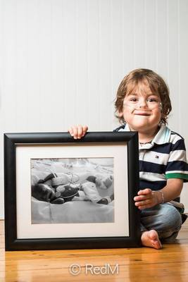 Трудный путь: трогательные фото недоношенных детей