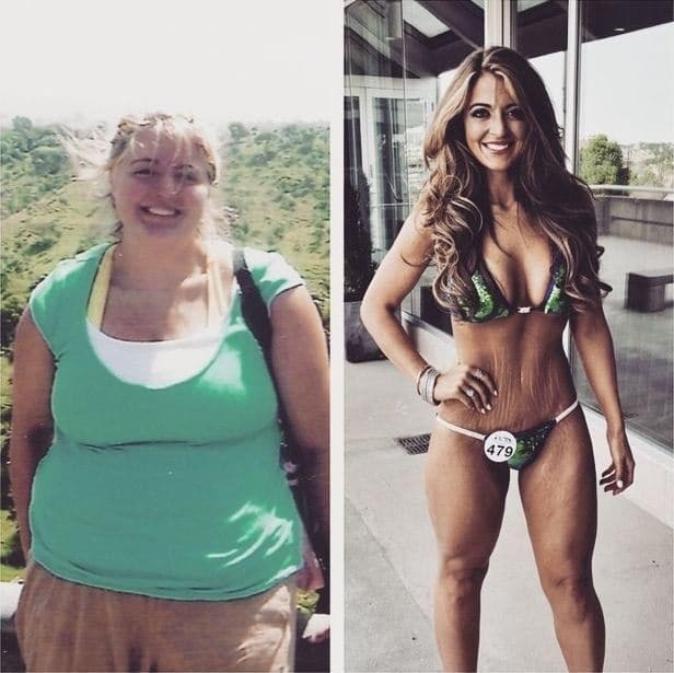 Шокирующие фото 21-летней девушки, похудевшей на 60 кг