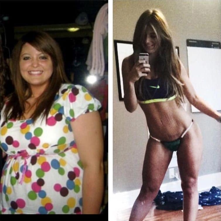 Шокирующие фото 21-летней девушки, похудевшей на 60 кг