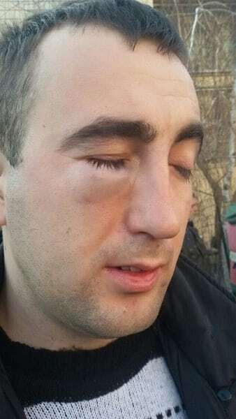 Драка чиновника РГА с экс-бойцом АТО: в полиции Киева сообщили подробности 