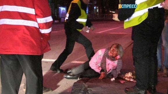 В Киеве водитель сбил на "зебре" женщину и скрылся