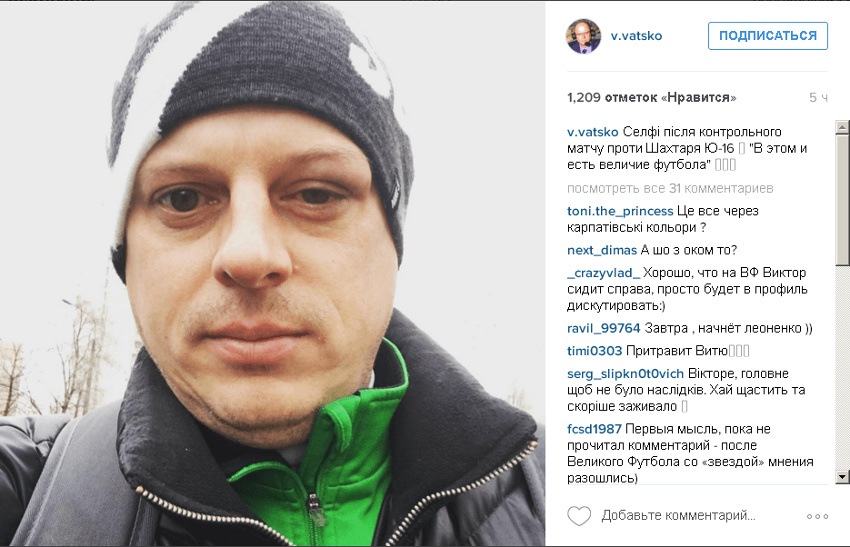 Футболісти "Шахтаря" підбили око знаменитому українському коментатору: фотофакт