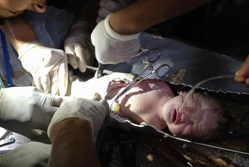 Невероятные истории выживания младенцев (фото)