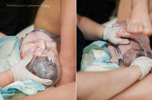 Роды в воде, плачущие матери и первые объятия: невероятный фотопроект