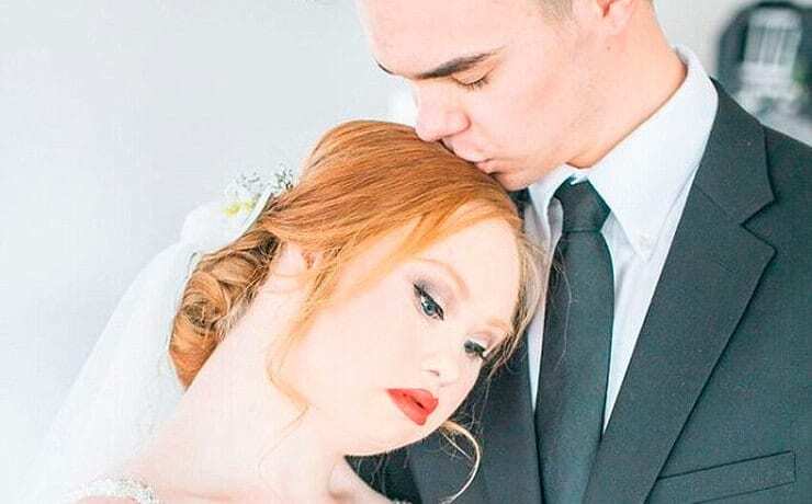 Модель с синдромом Дауна поразила свадебными фото