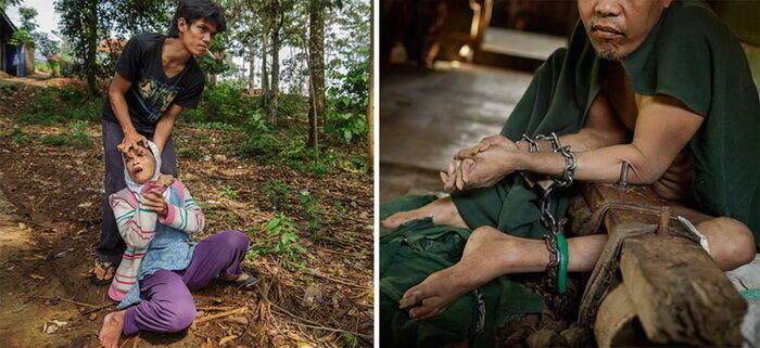 Шокирующие фото психиатрических лечебниц в Индонезии