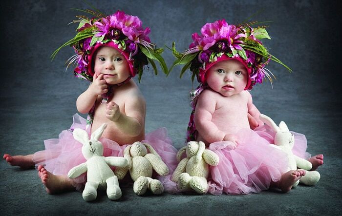 Малышки с синдромом Дауна снялись в потрясающей фотосессии ради благотворительности