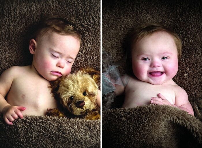 Малышки с синдромом Дауна снялись в потрясающей фотосессии ради благотворительности