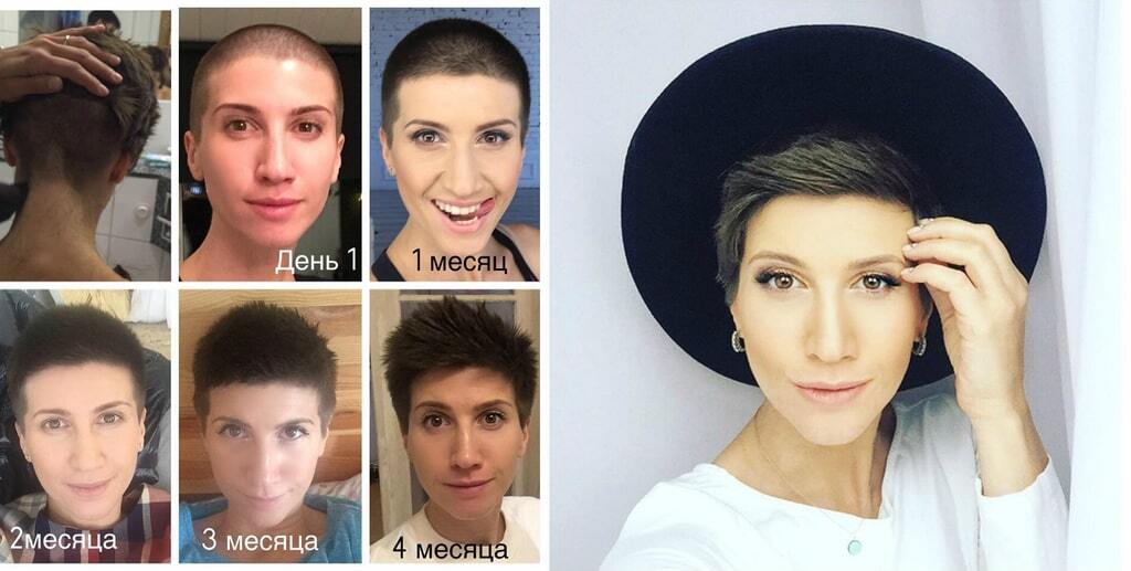Анита Луценко открыла секрет, почему коротко подстригла волосы 