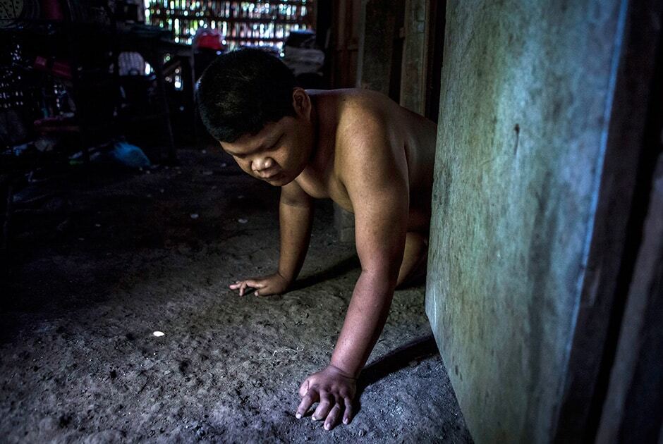 Клетки и цепи: появились жуткие фото о жизни людей с психическими отклонениями в Индонезии