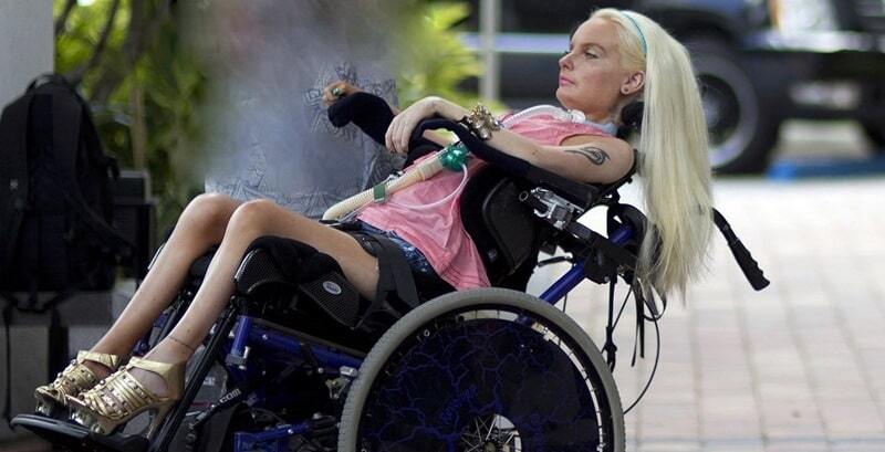 Как Барби: финка потратила $14 тысяч, чтобы изменить парализованное тело