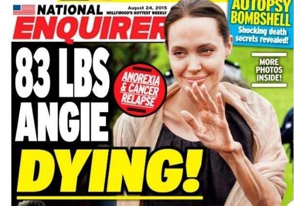 Прогрессирующая нервная анорексия: психотерапевт оценил внешность Анджелины Джоли