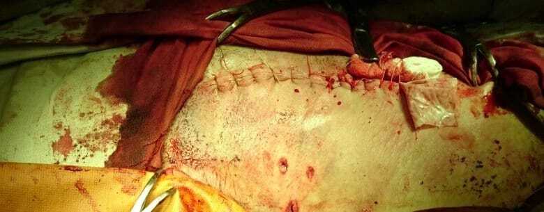 Врачи от Бога: в Днепропетровске "зашили" бойца со сквозным ранением сонной артерии. Фотофакт