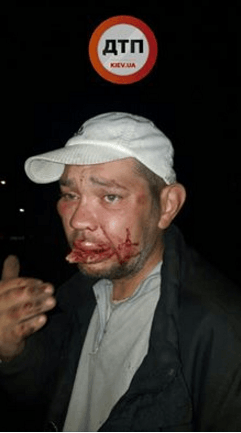 Не первый раз: в Киеве на Оболони люди с битами избили прохожих
