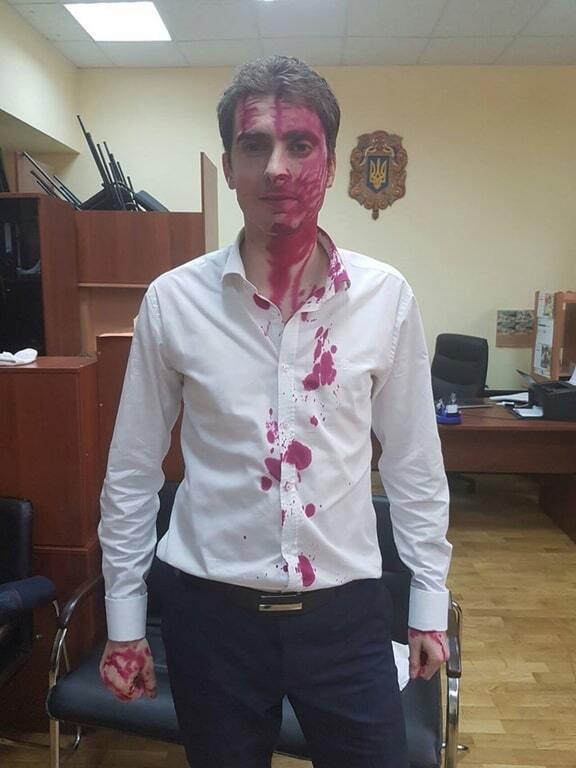 В Киеве нардепа облили марганцовкой: опубликовано фото