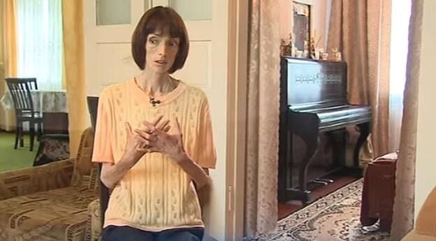 Смогла победить анорексию: история украинки, которая весила 24 кг
