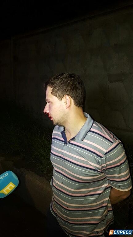 В Киеве пьяный водитель сбил насмерть девушку