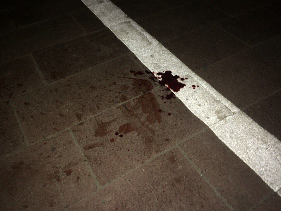 Біля Тернопільського ставу велосипедист впав та розбив голову (фото)