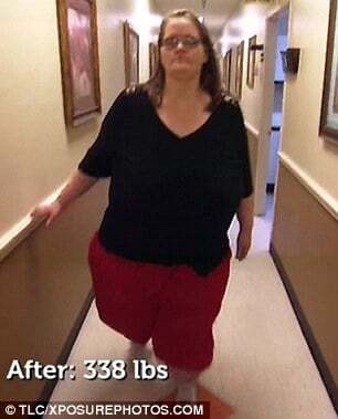 Найповніша жінка в світі схудла на 200 кг